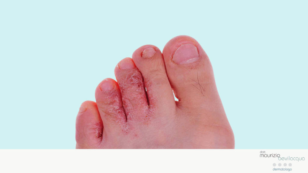 Dott. Maurizio Bevilacqua | Dermatologo a Caserta